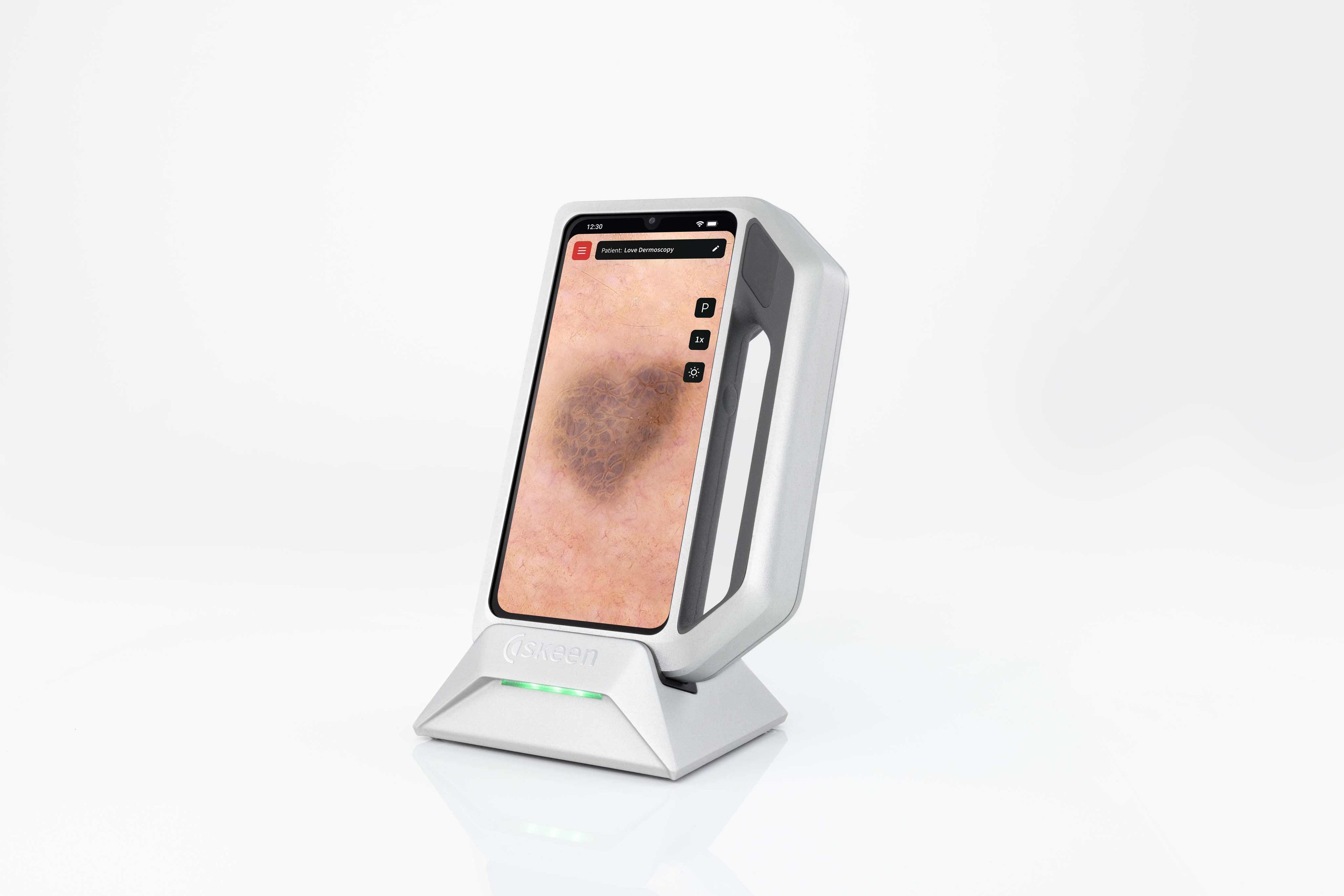 FotoFinder® skeen