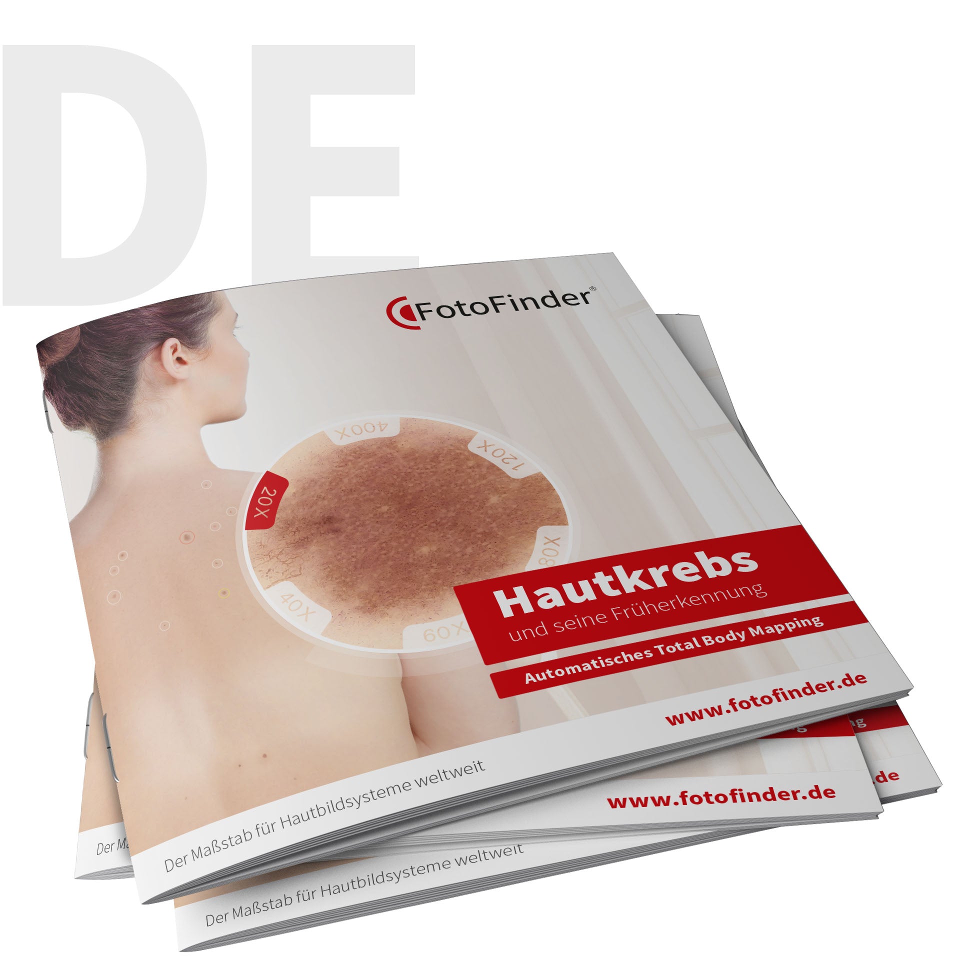 Patient Brochure Total Body Mapping