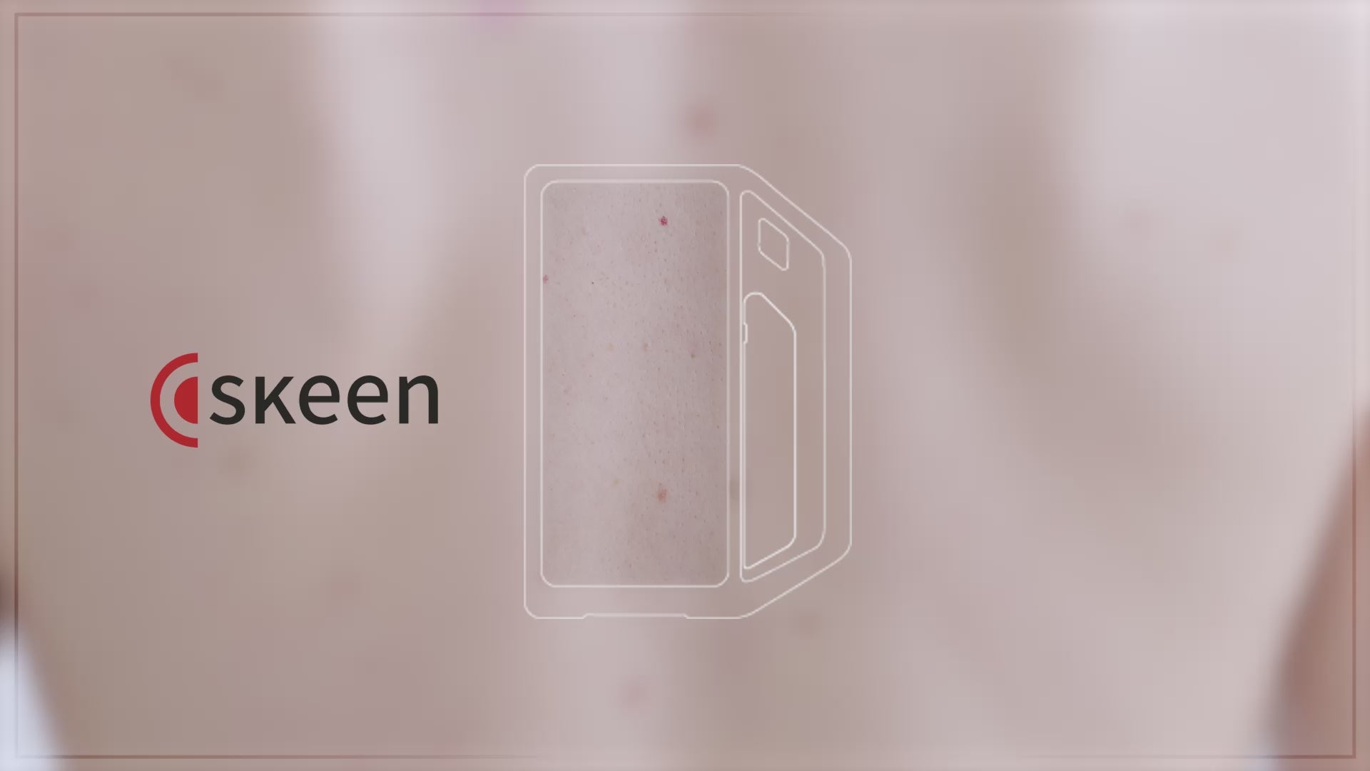 FotoFinder® skeen