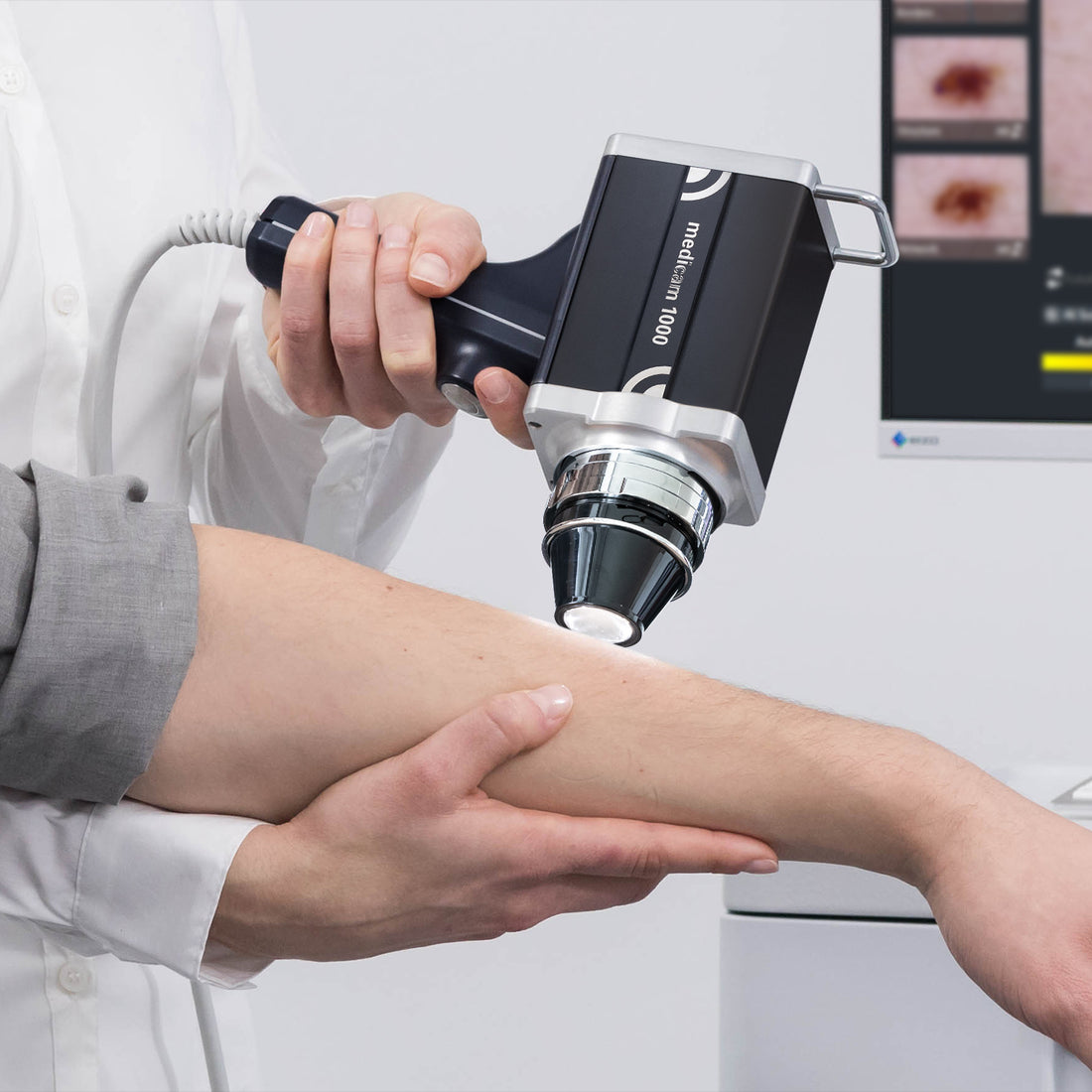 10x Closed front cap for D-Scope IV