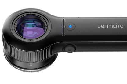 DermLite DL5 Plus