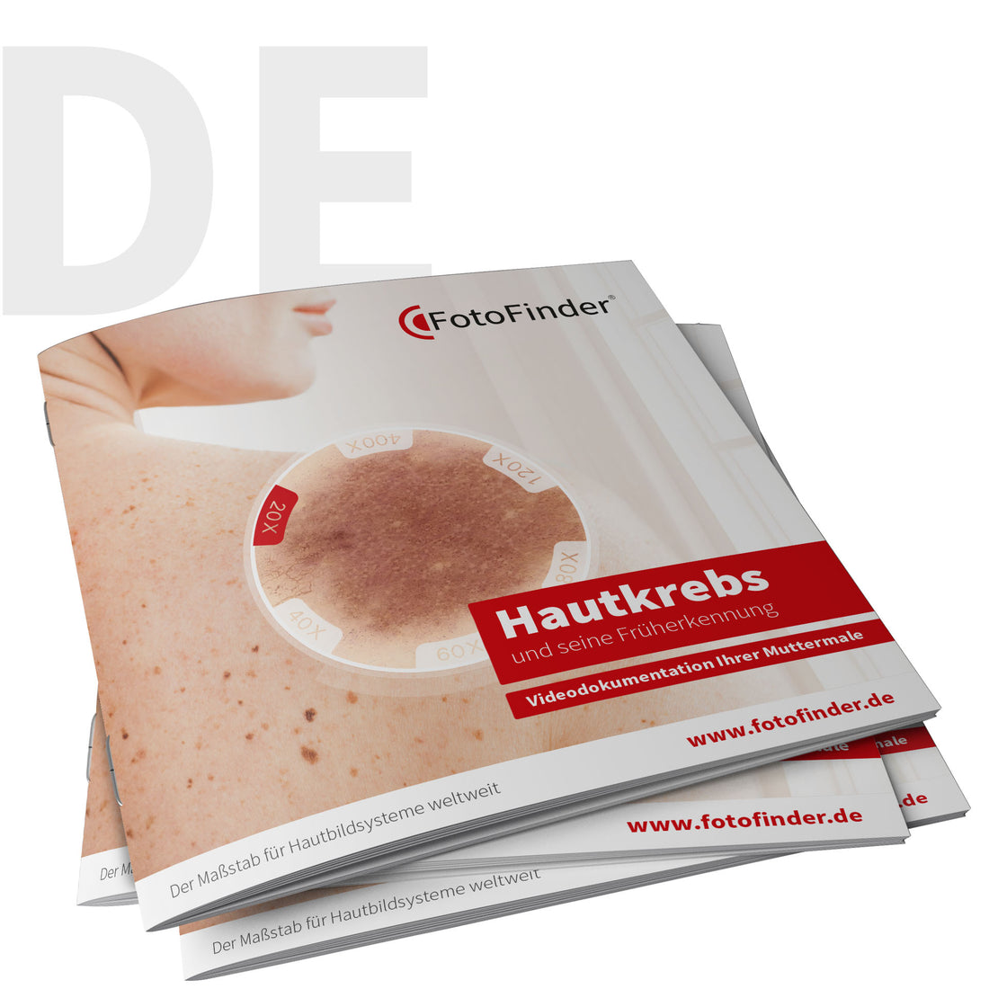 Patient Brochure Dermoscopy